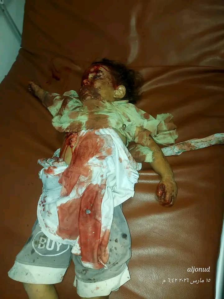 الحكومة اليمنية تقول إن ماجرى في حجة “جريمة حرب” وتحذر من الصمت