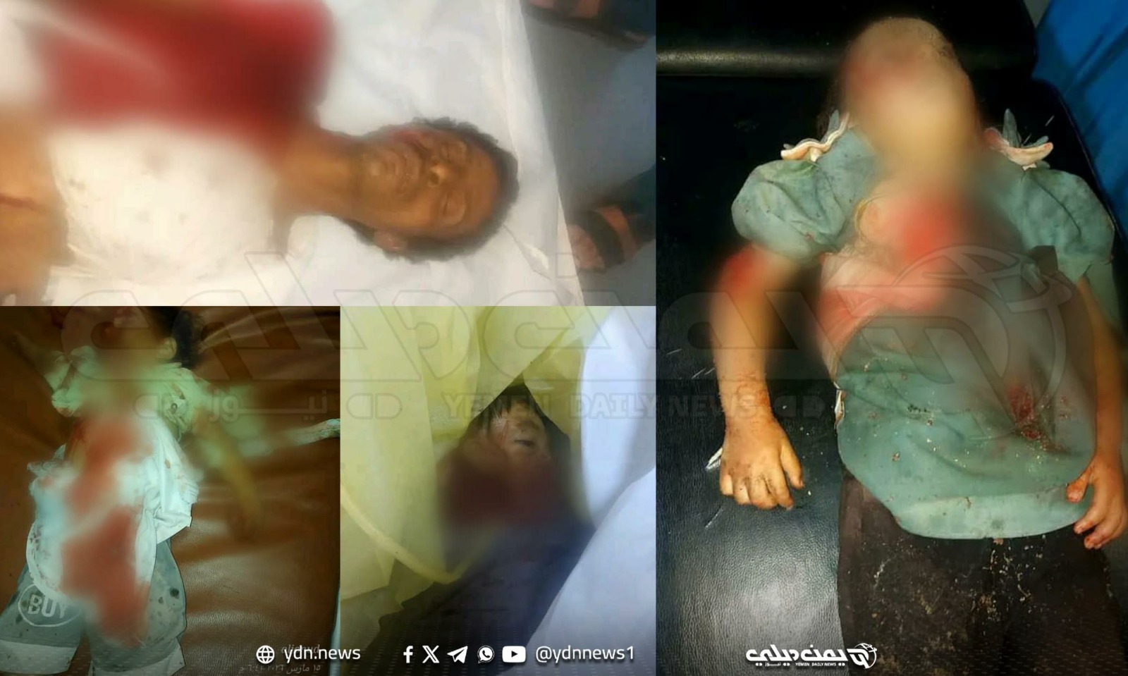 الحكومة اليمنية تقول إن ماجرى في حجة “جريمة حرب” وتحذر من الصمت