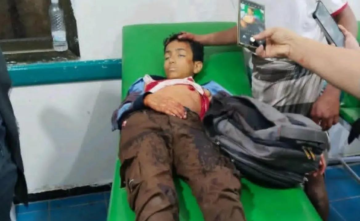 إبراهيم جلال.. طفل جديد في تعز يغادر الحياة برصاص قناصة الحوثيين