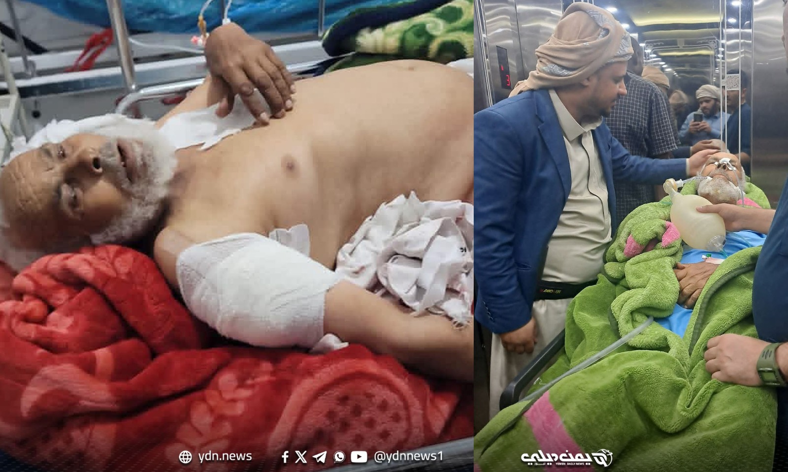 إصابة خطرة لإمام مسجد مسن في صنعاء عقب رفضه تعليق “الصرخة الخمينية”