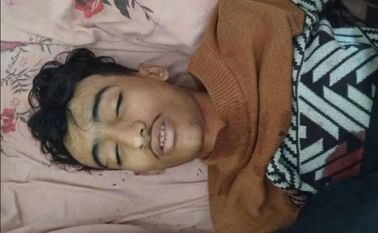 مركز حقوقي: وفاة طفل بعد يوم من استجواب الحوثيين له في ريف تعز