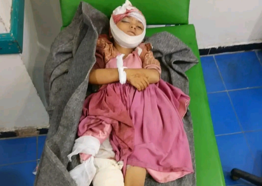 مصادر محلية: مقتل طفلة وإصابة 8 آخرين بقصف للحوثيين على قرية كحلان في تعز